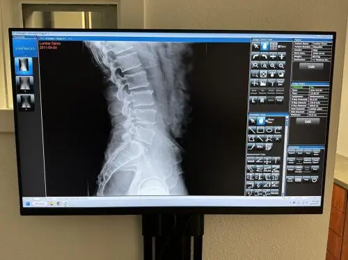 Best Chiropractor Services in Orlando, FL