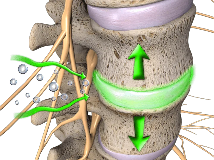 Spine vertebra with green nerves and directional arrows showing decompression movement