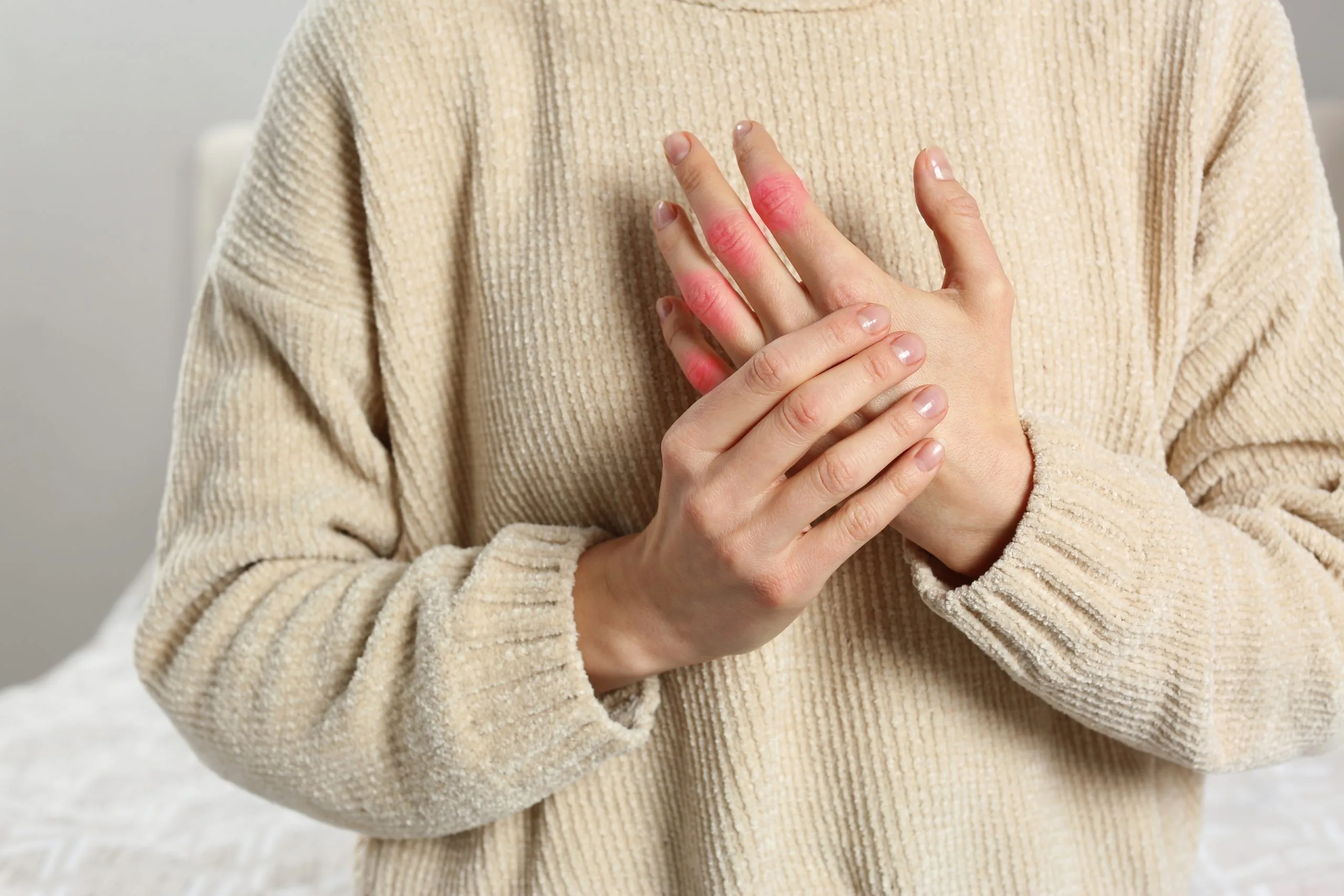 Woman holding hand with red inflammation marks highlighting joint pain in fingers